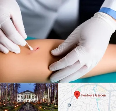 متخصص زخم عفونی در باغ فردوس 