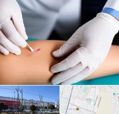 متخصص زخم عفونی در فاز دو اندیشه