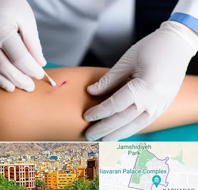 متخصص زخم عفونی در نیاوران 