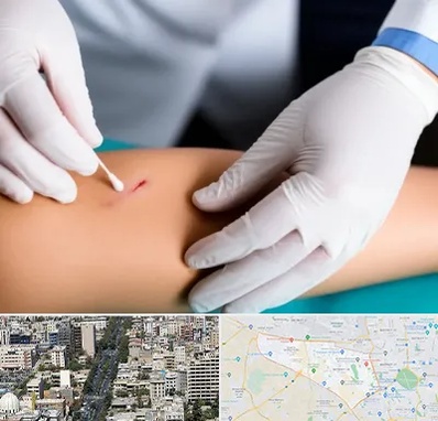 متخصص زخم عفونی در منطقه 18 تهران