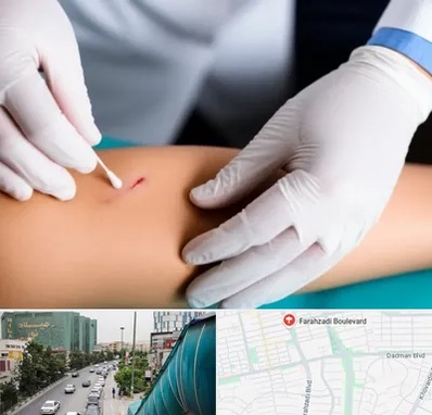 متخصص زخم عفونی در بلوار فرحزادی 