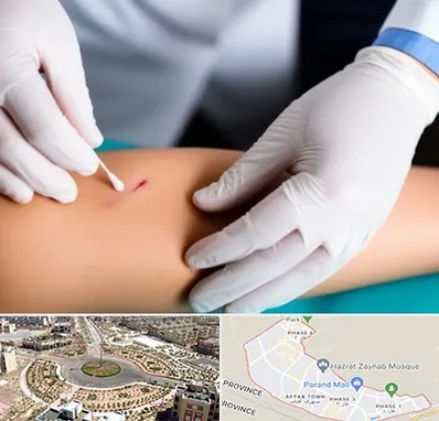 متخصص زخم عفونی در پرند