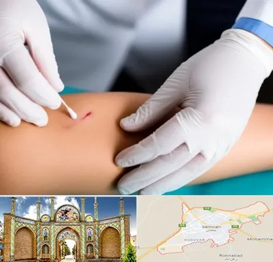 متخصص زخم عفونی در سمنان