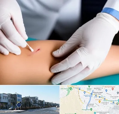 متخصص زخم عفونی در شریعتی مشهد 