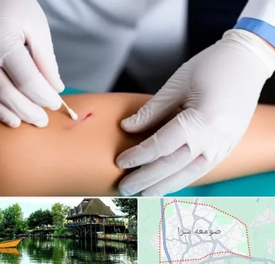 متخصص زخم عفونی در صومعه سرا