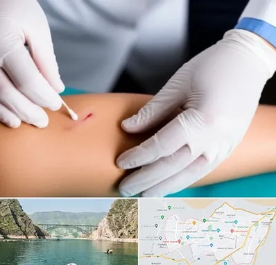 متخصص زخم عفونی در ایلام