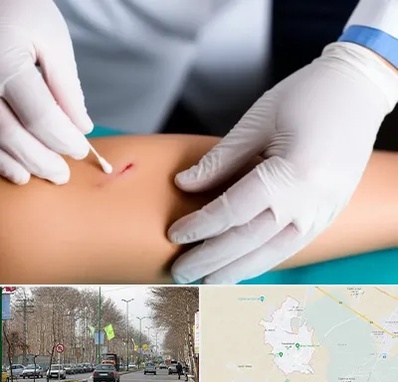 متخصص زخم عفونی در نظرآباد کرج 