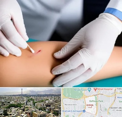 متخصص زخم عفونی در گیشا 