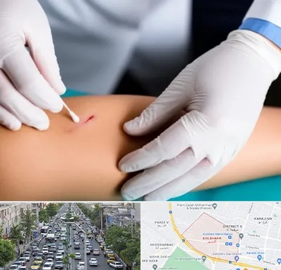 متخصص زخم عفونی در گلشهر کرج 