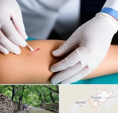 متخصص زخم عفونی در شاندیز مشهد 