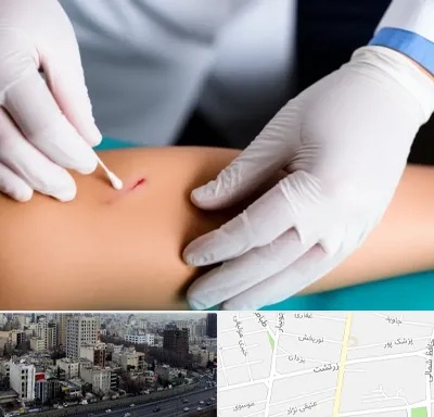 متخصص زخم عفونی در زرتشت