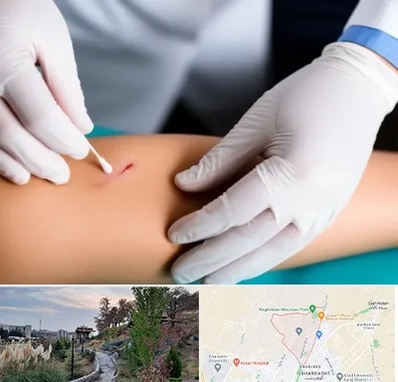 متخصص زخم عفونی در باغستان کرج 