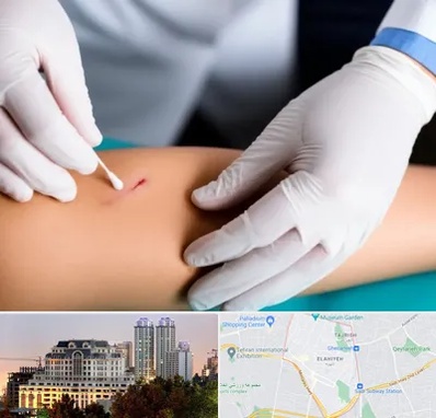 متخصص زخم عفونی در فرشته 