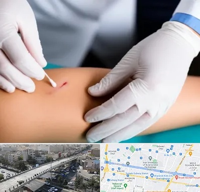 متخصص زخم عفونی در فرجام 