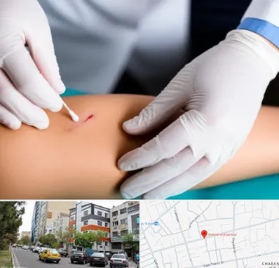 متخصص زخم عفونی در هفده شهریور تبریز 