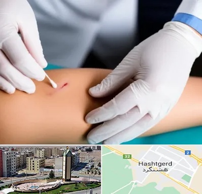 متخصص زخم عفونی در هشتگرد