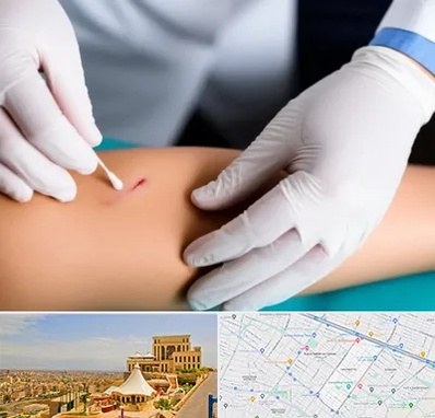 متخصص زخم عفونی در هاشمیه مشهد 