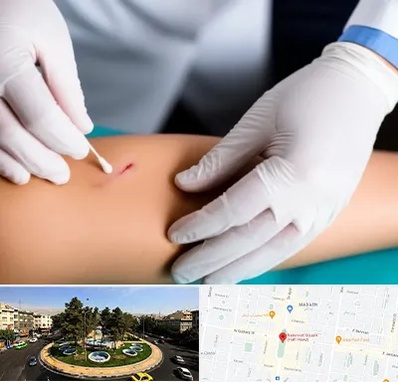 متخصص زخم عفونی در هفت حوض