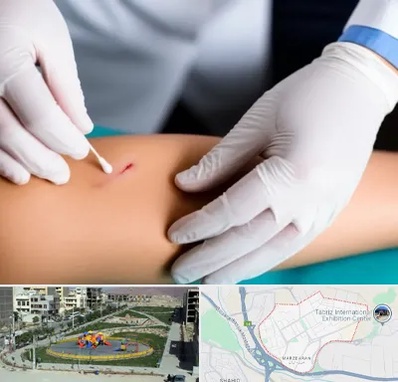 متخصص زخم عفونی در مرزداران تبریز 