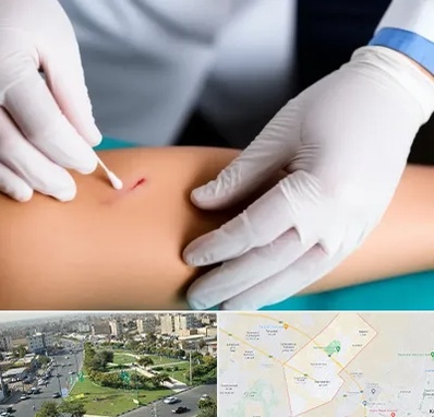 متخصص زخم عفونی در کمال شهر کرج 