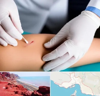 متخصص زخم عفونی در هرمزگان