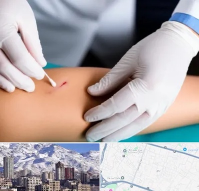 متخصص زخم عفونی در ازگل 