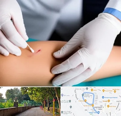 متخصص زخم عفونی در بلوار گیلان رشت 