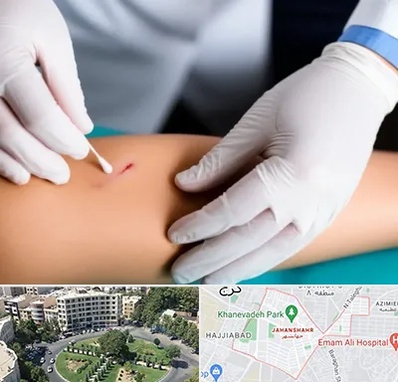 متخصص زخم عفونی در جهانشهر کرج 