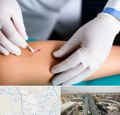 متخصص زخم عفونی در حصارک کرج 