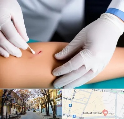 متخصص زخم عفونی در تربیت تبریز 