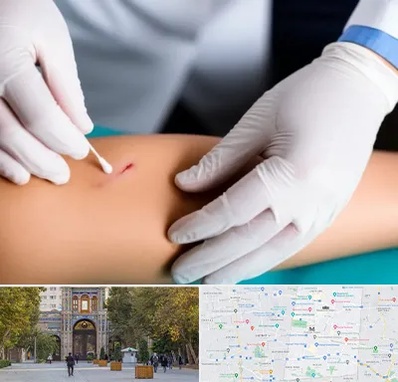 متخصص زخم عفونی در منطقه 12 تهران 