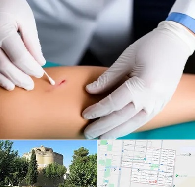 متخصص زخم عفونی در مرداویج اصفهان 