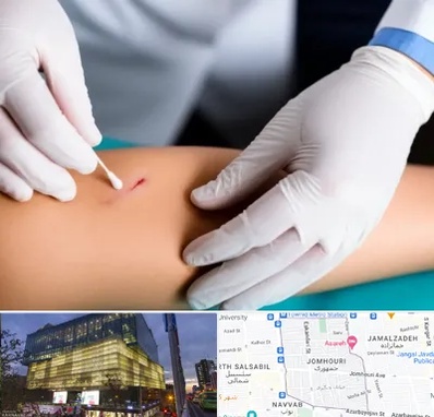 متخصص زخم عفونی در جمهوری 