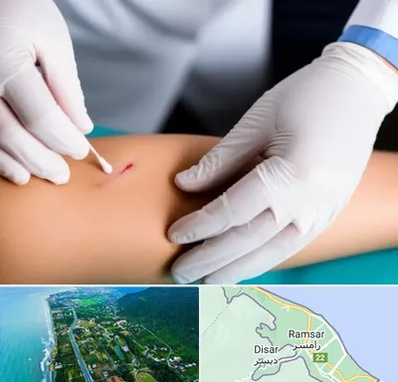 متخصص زخم عفونی در رامسر