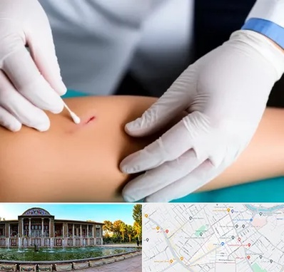 متخصص زخم عفونی در عفیف آباد شیراز 