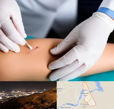 متخصص زخم عفونی در میناب