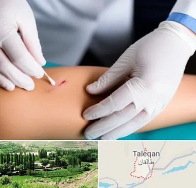 متخصص زخم عفونی در طالقان