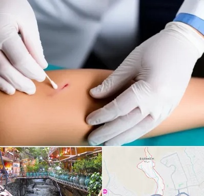 متخصص زخم عفونی در درکه 