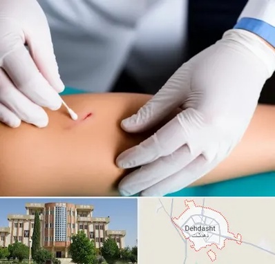 متخصص زخم عفونی در دهدشت