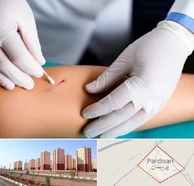 متخصص زخم عفونی در پردیسان قم 