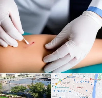 متخصص زخم عفونی در گلستان اهواز 