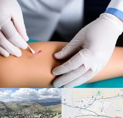 متخصص زخم عفونی در رودهن