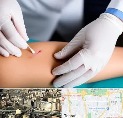 متخصص زخم عفونی در مرزداران 