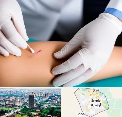 متخصص زخم عفونی در ارومیه