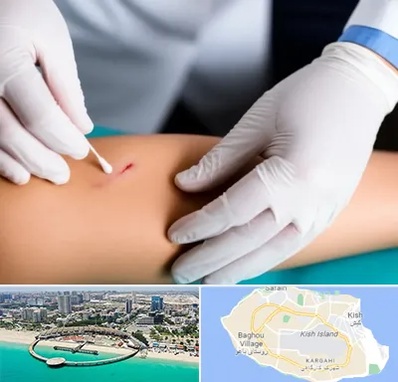 متخصص زخم عفونی در کیش