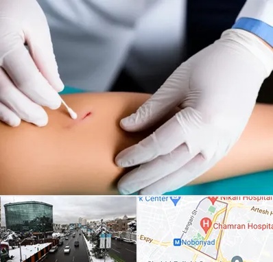 متخصص زخم عفونی در اقدسیه 