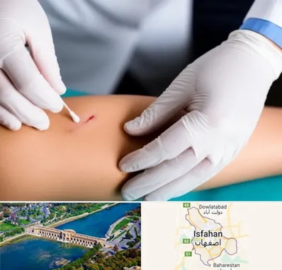 متخصص زخم عفونی در اصفهان