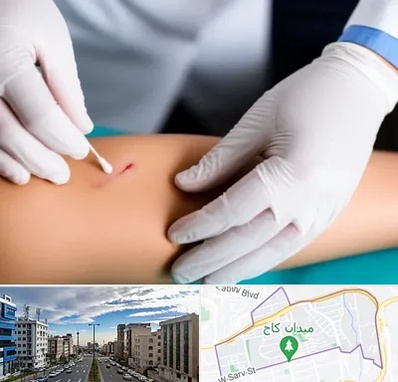 متخصص زخم عفونی در سعادت آباد 