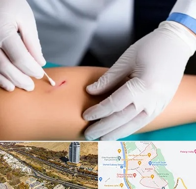 متخصص زخم عفونی در خیابان نیایش شیراز 