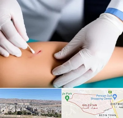 متخصص زخم عفونی در شهرک گلستان شیراز 